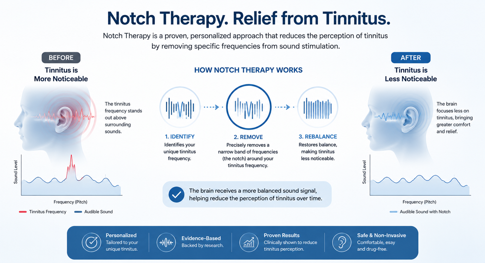 Notch therapy for tinnitus relief - EarMart Hearing Solutions Notch therapy for tinnitus relief
